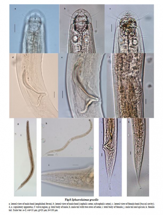 Sphaerolaimus gracilis Sphaerolaimus gracilis