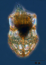 Dictyocysta mülleri