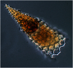 A deep sea radiolarian, Cornutella profunda