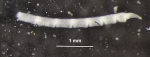Retiometra alascana A. H. Clark, 1936