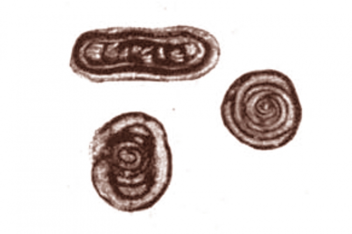 Glomospira ammodiscoidea Rauzer-Chernousova, 1938 Glomospira ammodiscoidea Rauzer-Chernousova, 1938