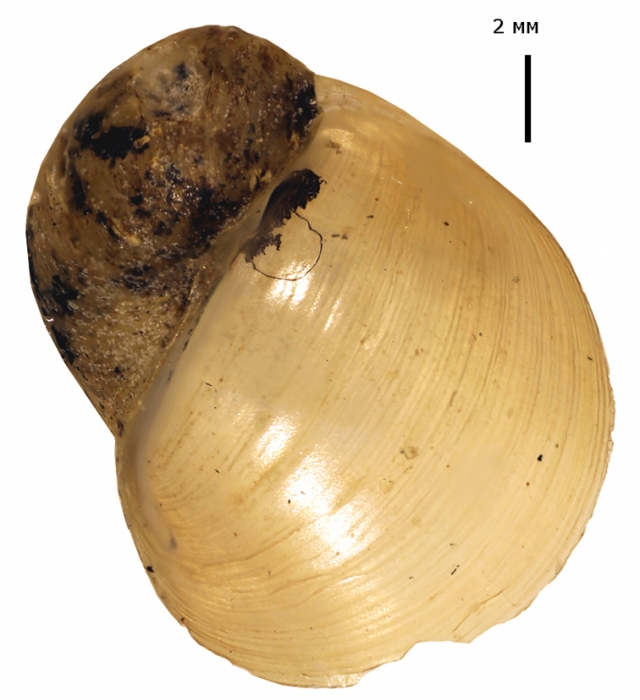 Radix onychia