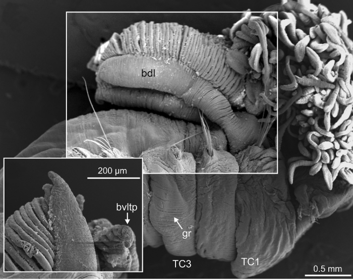 Terebellides ronningae Parapar, Capa, Nygren & Moreira, 2020; original figure: fig. 20A-B