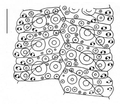 Pachycentrotus australiae (ambulacral plates)