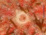 Gracilechinus acutus norvegicus (apical area)