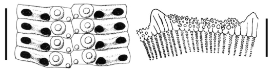 Acanthocidaris hastigera (ambulacral plates + primary spines)