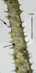 Filaments of Echinophyces mirabilis