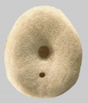 Echinocyamus pusillus (oral)