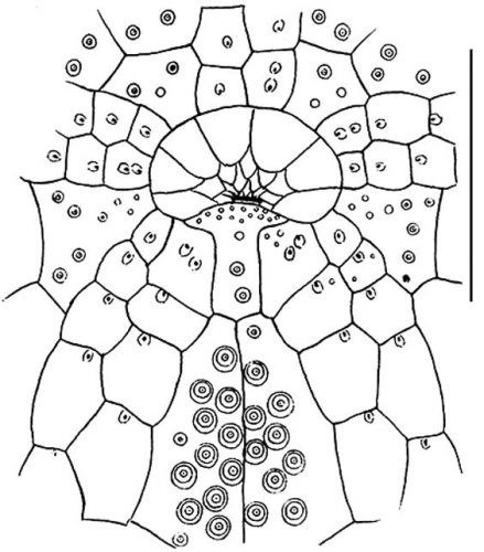 Palaeobrissus hilgardi (peristomial area)