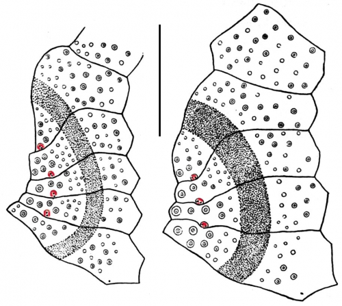 Brissopsis (part of subanal fasciole)