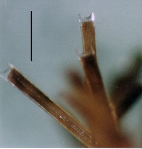 Amphipneustes bifidus (spines)