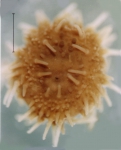 Amphipneustes rostratus (juvenile, aboral)