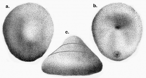 Cystechinus wyvillii (Challenger Expedition)