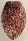 Pourtalesia hispida (aboral)