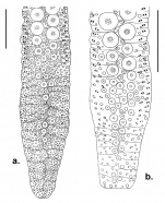 Chaetodiadema (oral ambulacra)