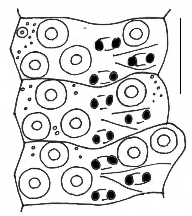Microcyphus rousseaui (ambulacral plates)
