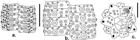 Gymnechinus robillardi (coronal plates and apical disc)