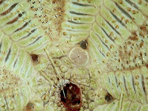 Asthenosoma varium (apical system)