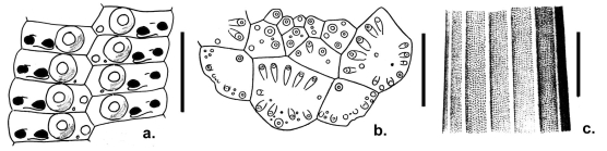 Kionocidaris striata (ambularal plates, apical disc and spine surface)