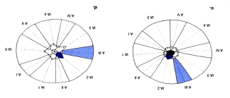 Echinometridae (diagrammatic scheme of ambulacra and interambulacra)