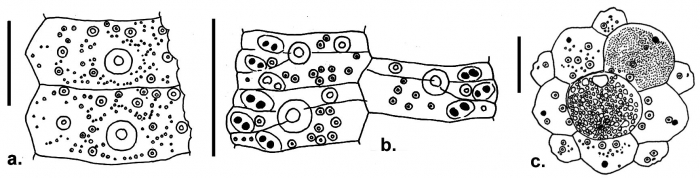 Sterechinus bernasconiae (coronal plates and apical disc)