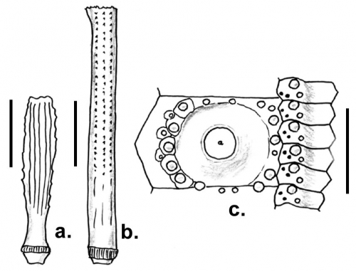 Goniocidaris magi (primary spines and coronal plates)