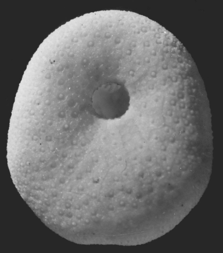 Aphanopora echinobrissoides (oral)