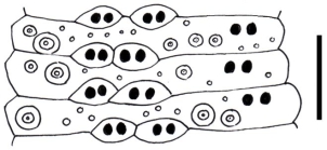 Araeosoma owstoni (ambulacral plates)