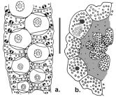 Aspidodiadema meijerei (ambulacral plates + apical system)