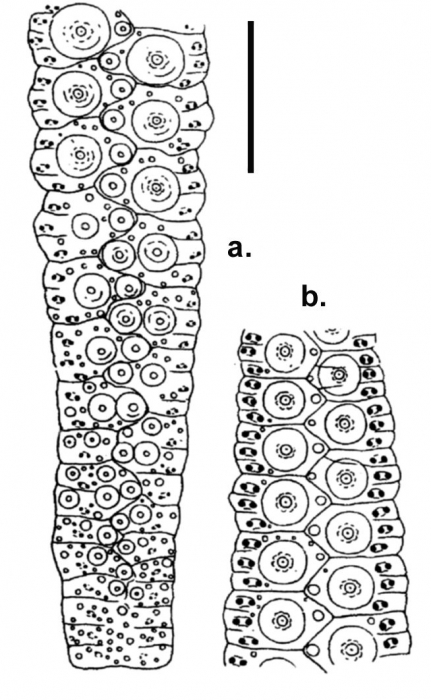 Chaetodiadema japonicum (ambulacral plates)