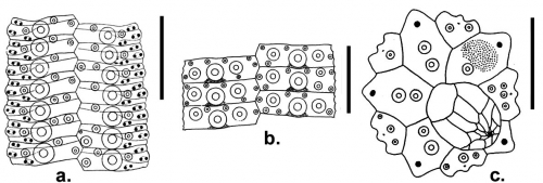 Gymnechinus epistichus (coronal plates and apical disc)