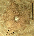 Hygrosoma hoplacantha (peristome)