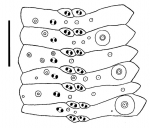 Hygrosoma hoplacantha (ambulacral plates)