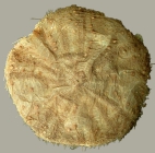 Hygrosoma hoplacantha (aboral)