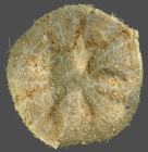 Phormosoma verticillatum (aboral)
