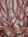 Rhodophyta (red algae)