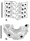 Psilocidaris echinulata (ambulacral plates + apical system)
