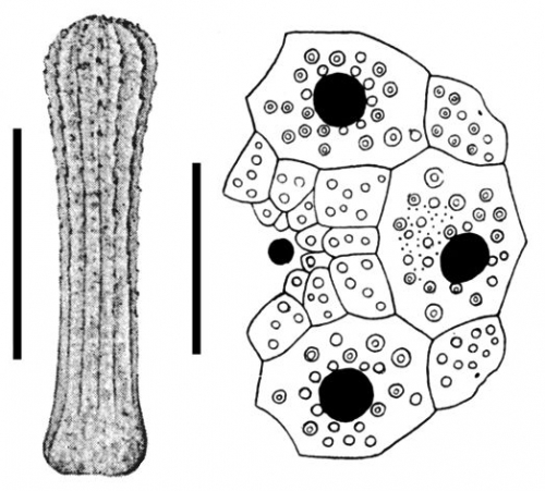 Rhopalocidaris hirsutispina (spine + apical system)