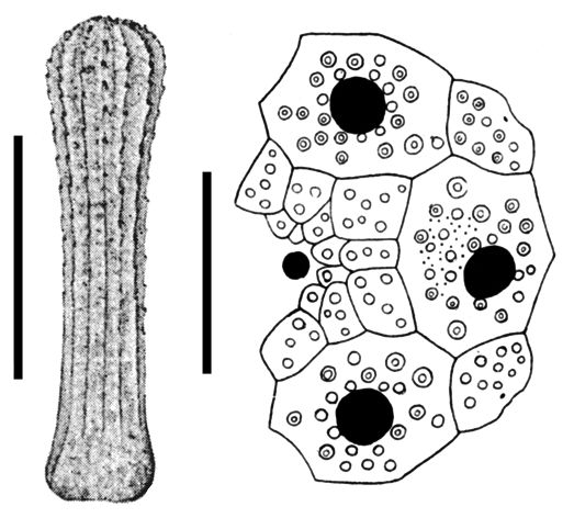 Rhopalocidaris hirsutispina (spine + apical system)