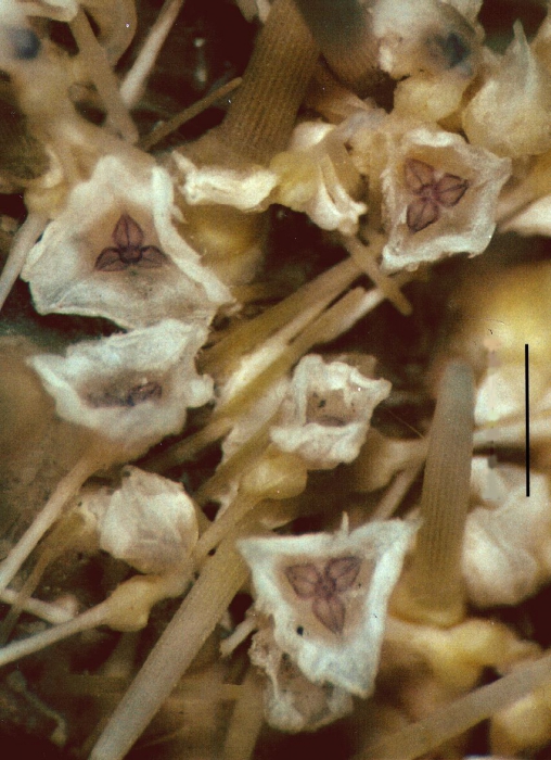 Toxopneustes roseus (globiferous pedicellariae) Toxopneustes roseus (globiferous pedicellariae)