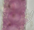 Rhodophyta (red algae)