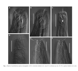 Acantholaimus Allg, 1933