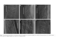 Acantholaimus Allg, 1933