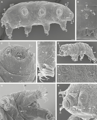 Neoechiniscoides aski Møbjerg, Jørgensen & Kristensen, 2020