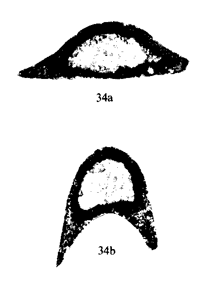 Eotuberitina firmata Conil & Lys, 1964 Eotuberitina firmata Conil & Lys, 1964