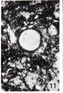 Tuberitina collosa subsp. spinosa Lys, 1980