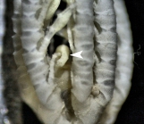 Thaumatometra septentrionalis A. H. Clark, Holotype, Copenhagen CRI-43