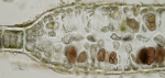 Haraldiophyllum bonnemaisonii