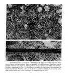 Astomonema jenneri Ott, Rieger, Rieger & Enderes, 1982