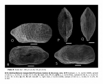 Semicytherura musacchioi